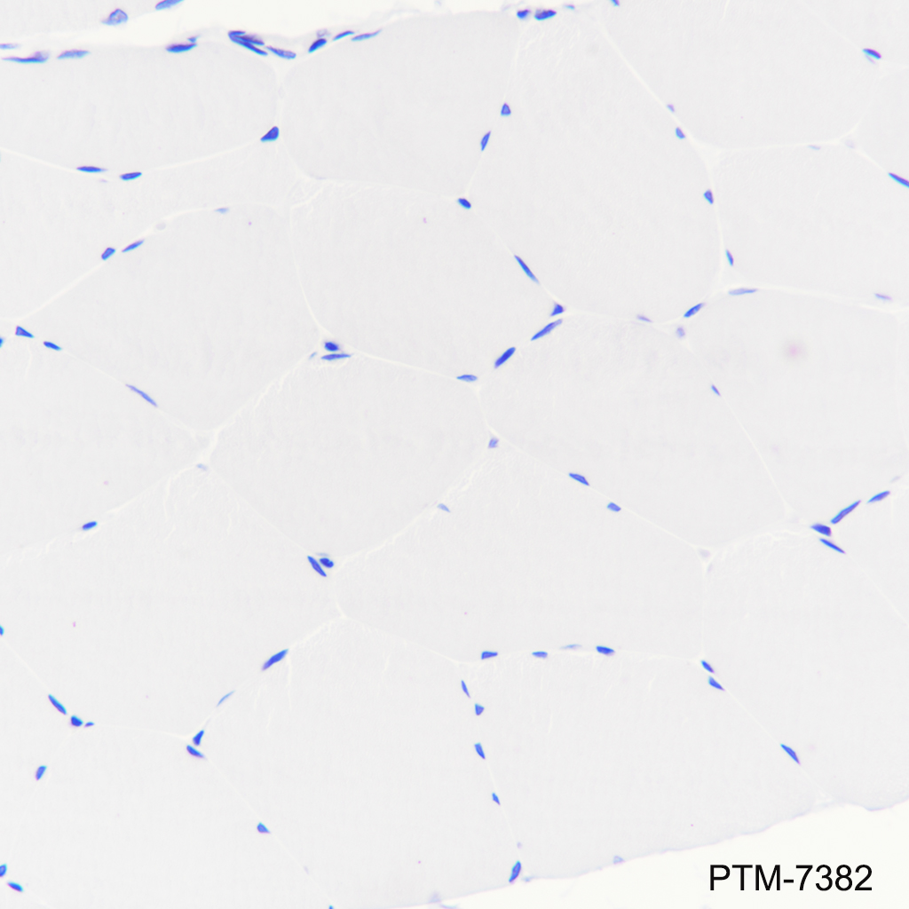 Anti-LAP3 Mouse mAb