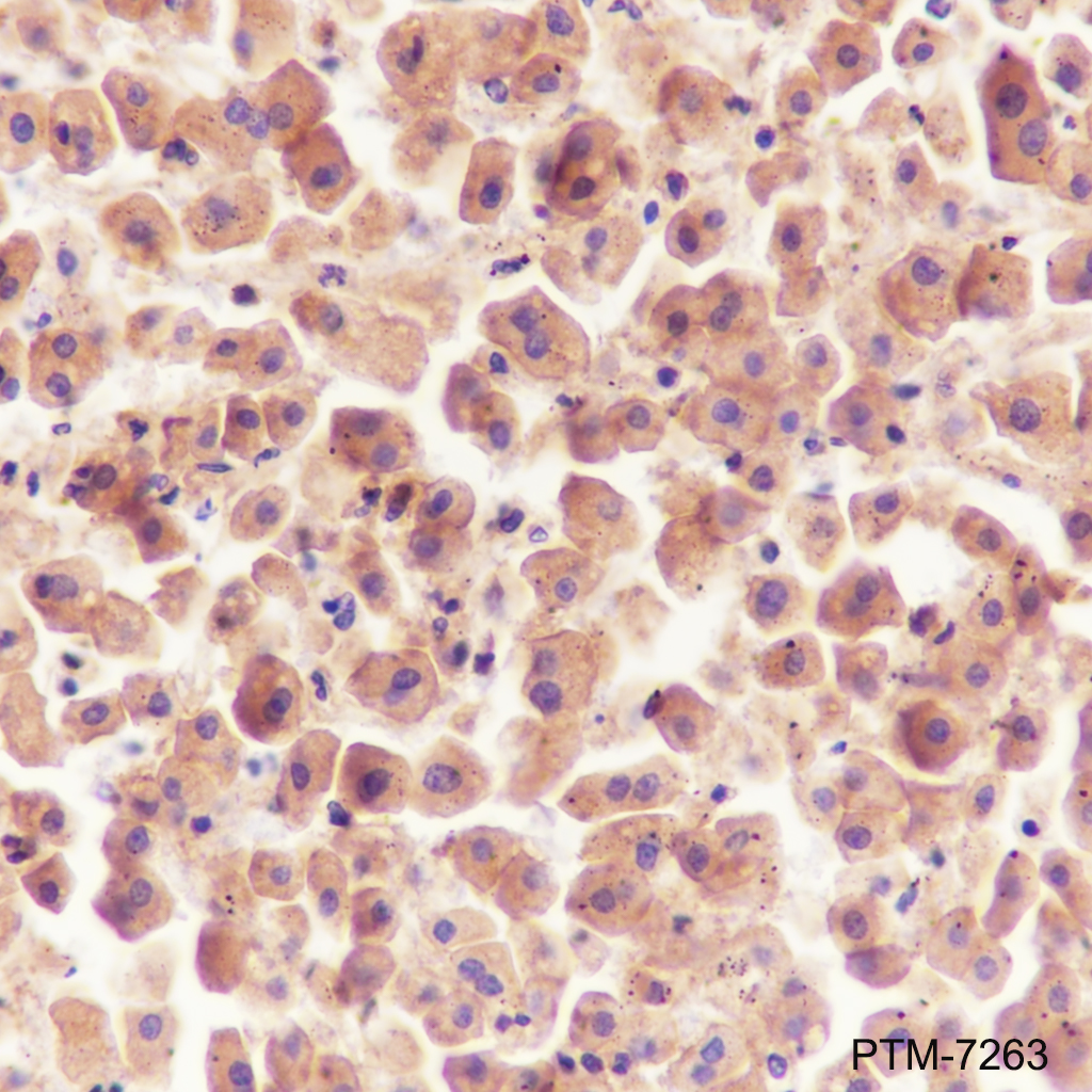 Anti-ApoH Mouse mAb