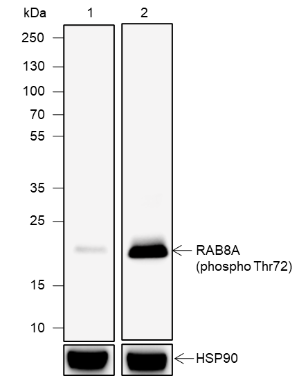 Anti-Phospho-Rab8A (Thr72) Rabbit mAb