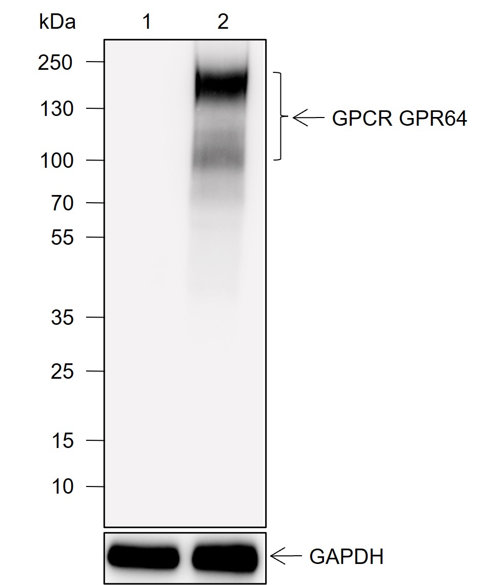 Anti-GPR64 Rabbit mAb
