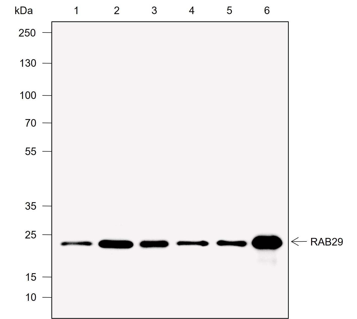 Anti-Rab29 Rabbit mAb