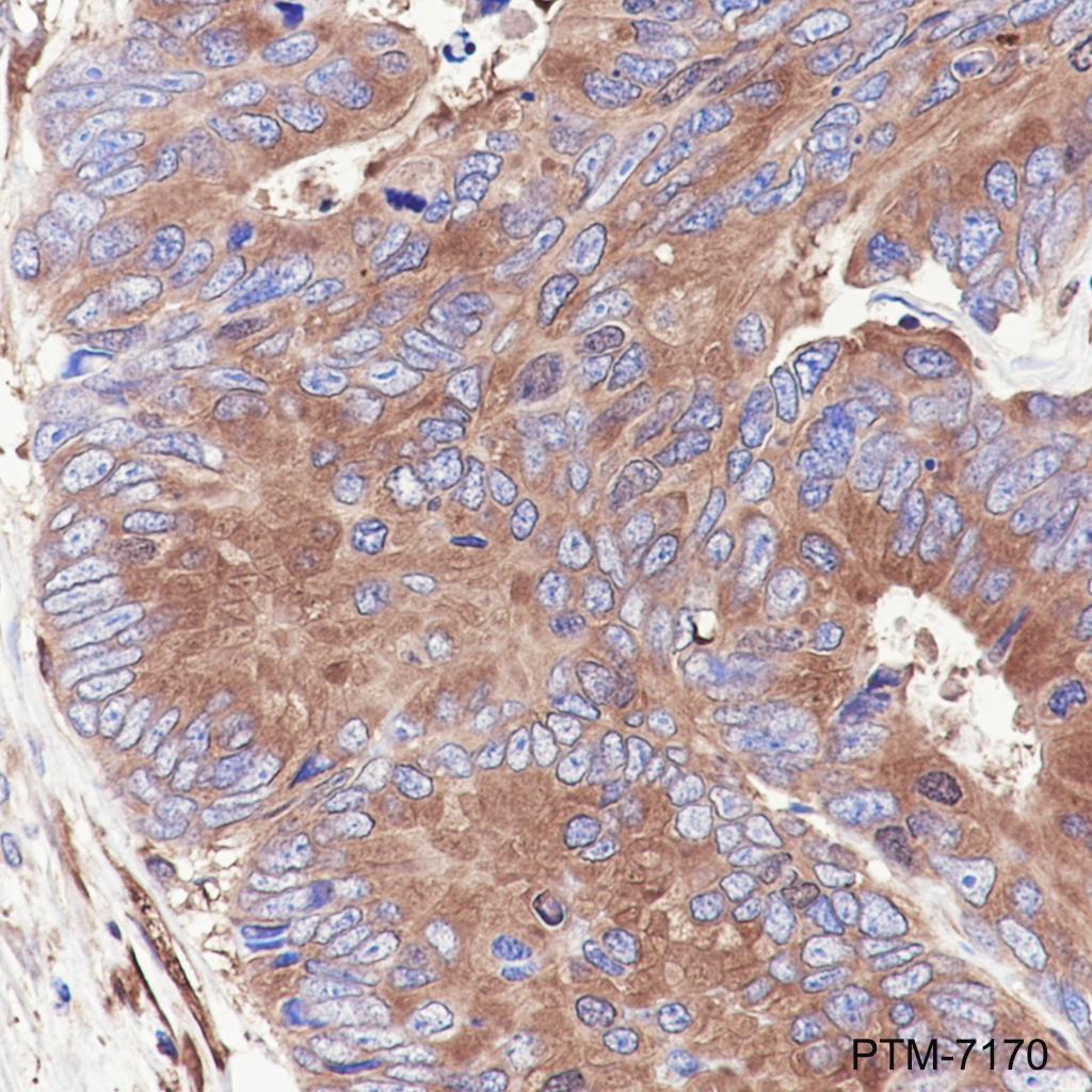Anti-PKM Rabbit mAb