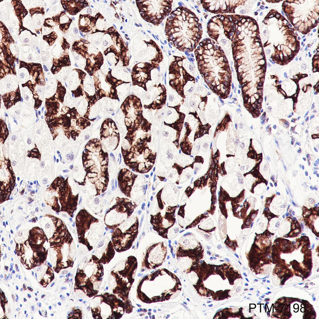 Anti-Rab3D Mouse mAb