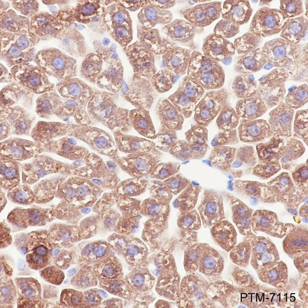 Anti-MBL2 Rabbit mAb