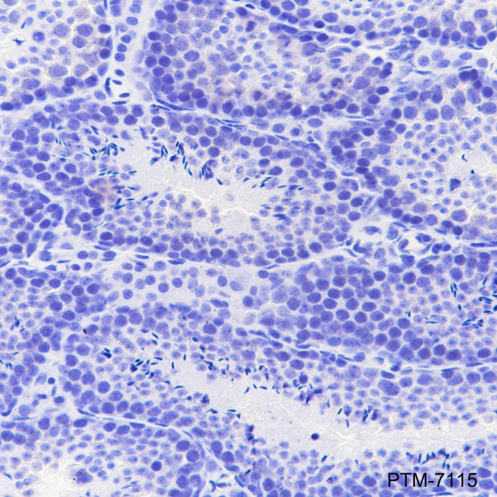 Anti-MBL2 Rabbit mAb