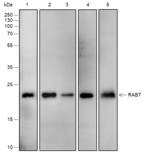 Anti-Rab7 Rabbit mAb