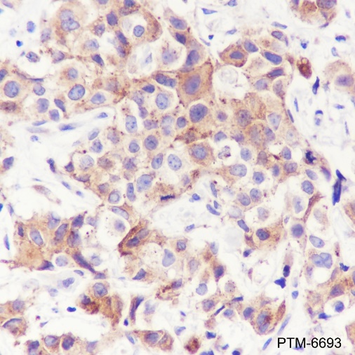 Anti-Rab7 Rabbit mAb