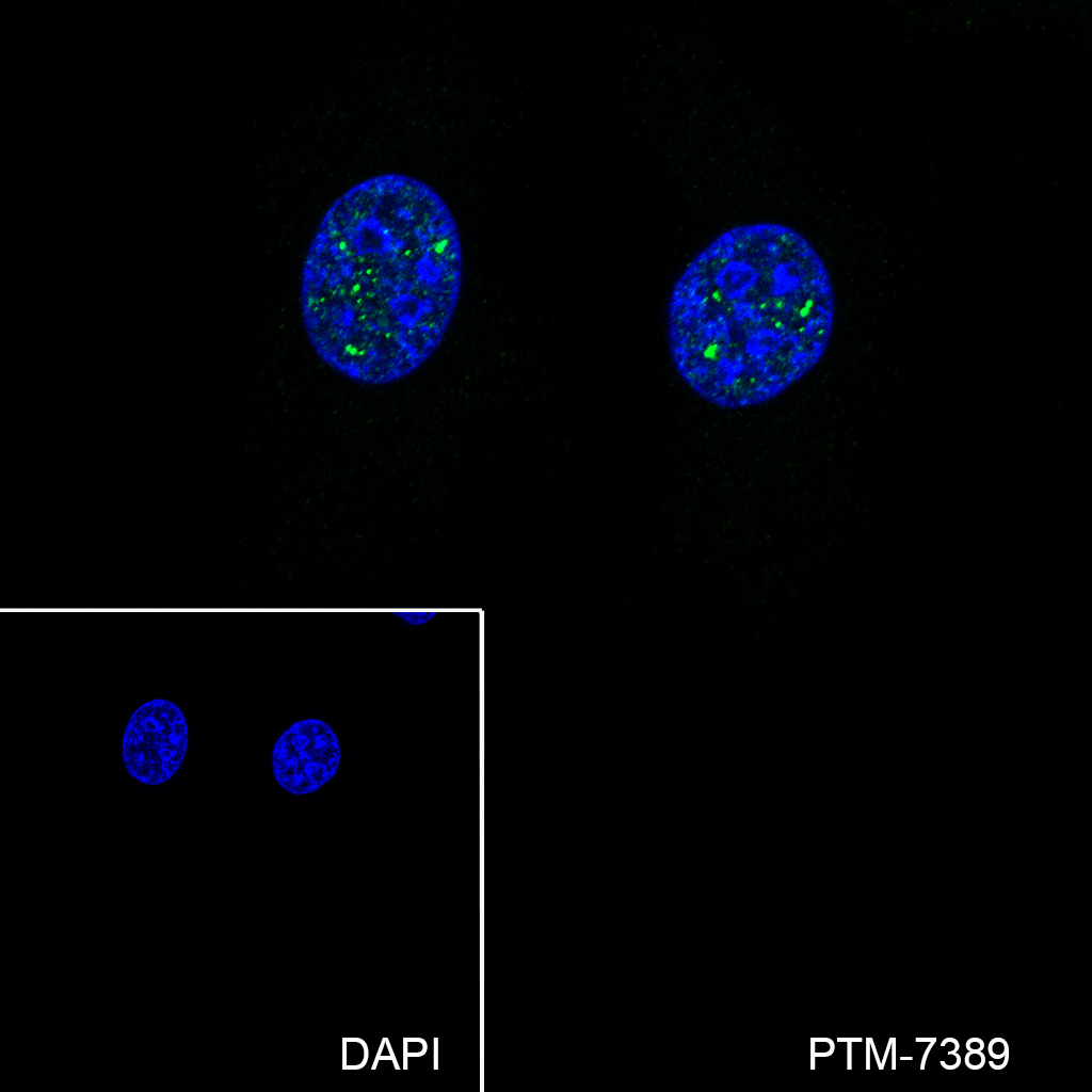Anti-MYST1 Mouse mAb