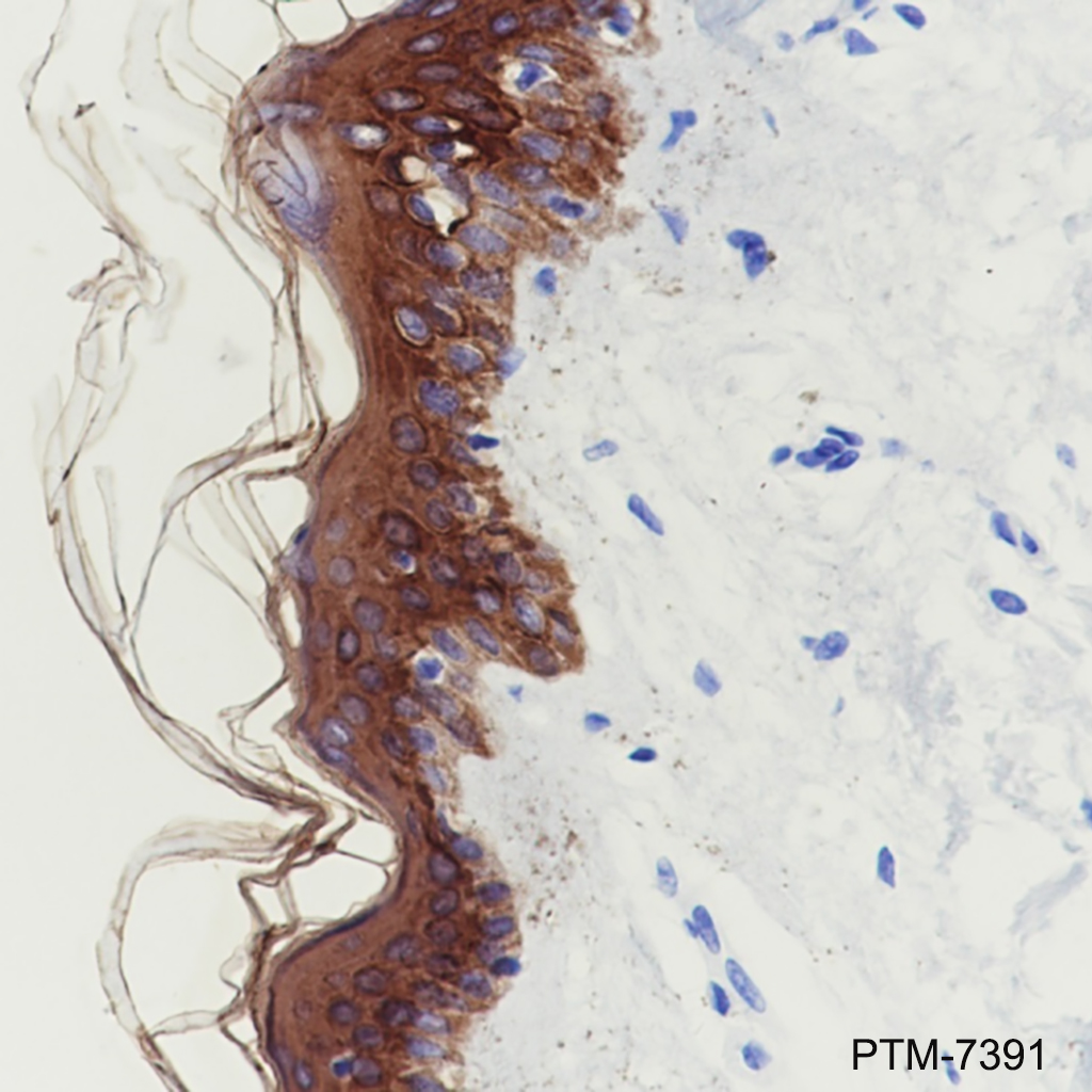 Anti-Pan-Keratin Mouse mAb