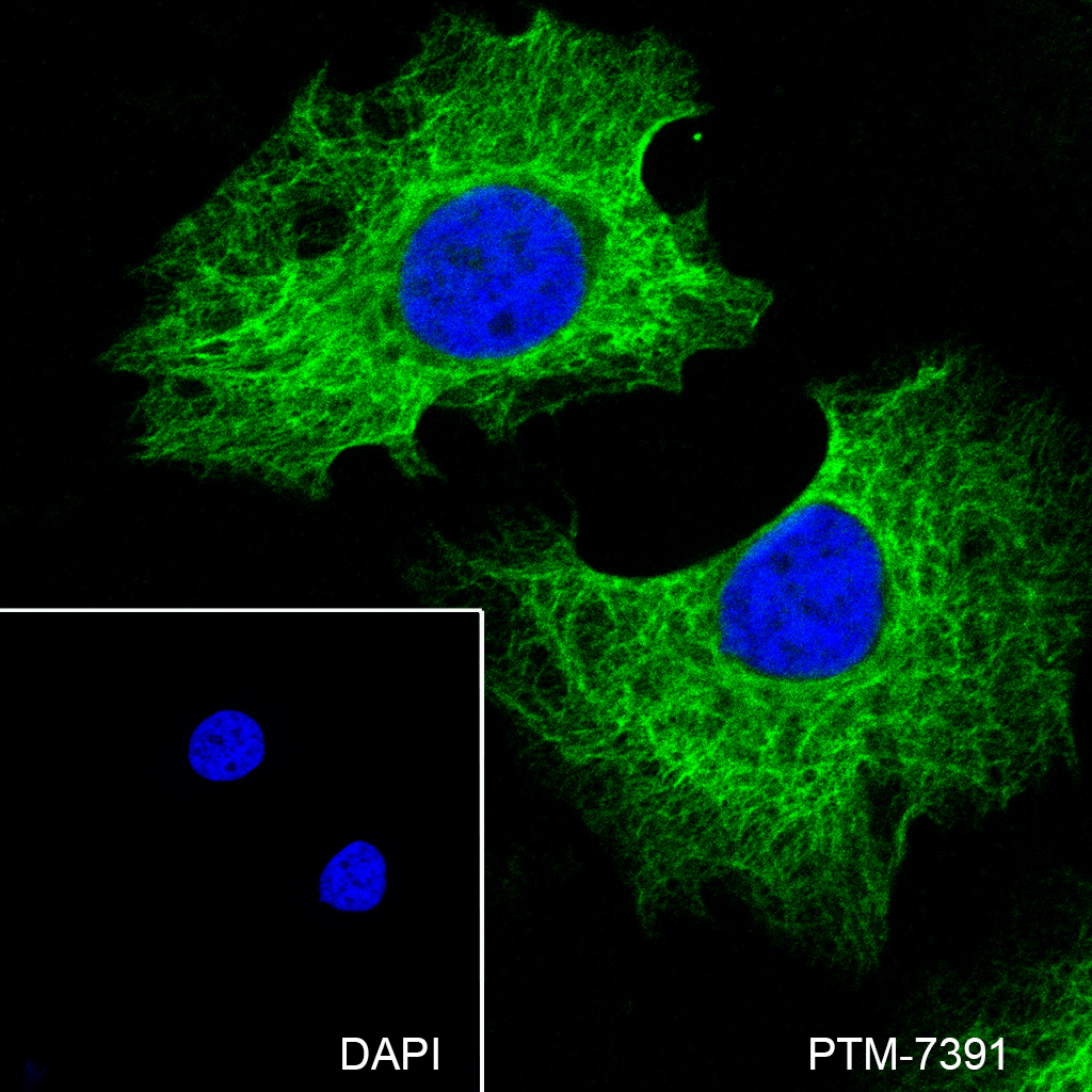 Anti-Pan-Keratin Mouse mAb
