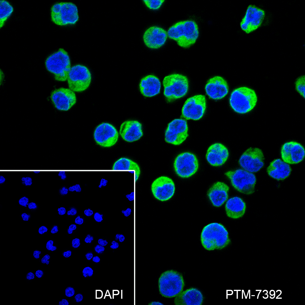 Anti-OAS2 Mouse mAb