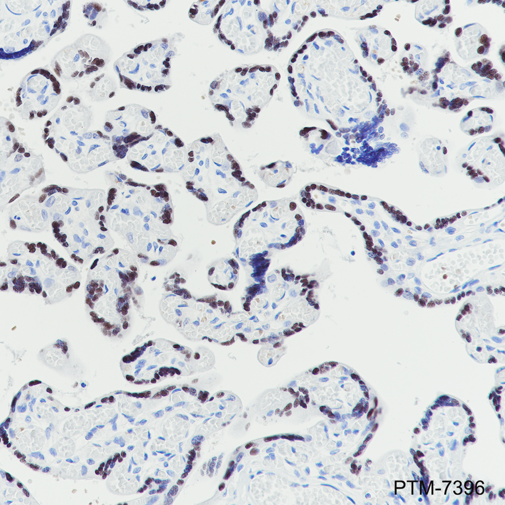 Anti-ATF3 Rabbit mAb