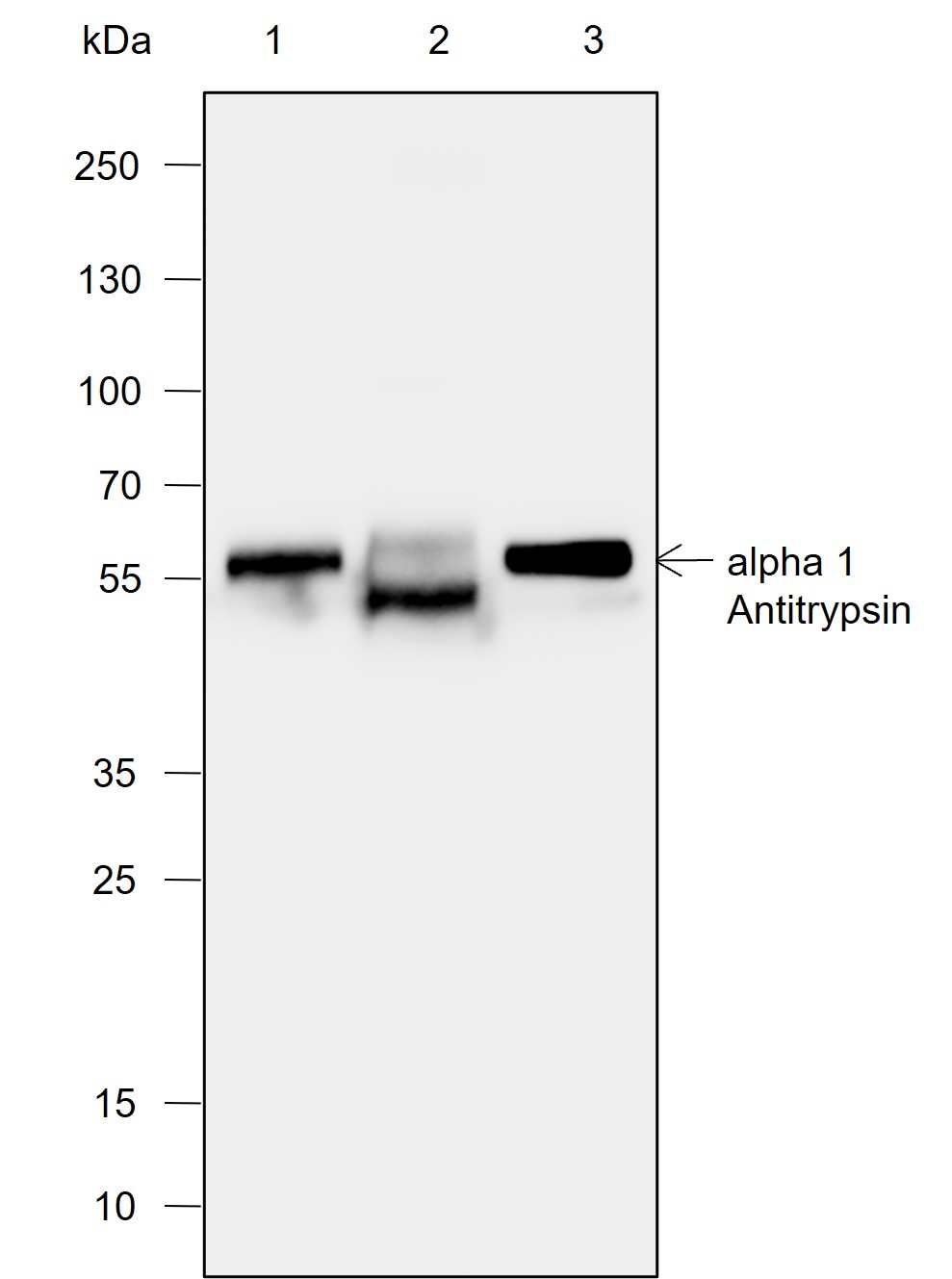 Anti-alpha 1 Antitrypsin Mouse mAb