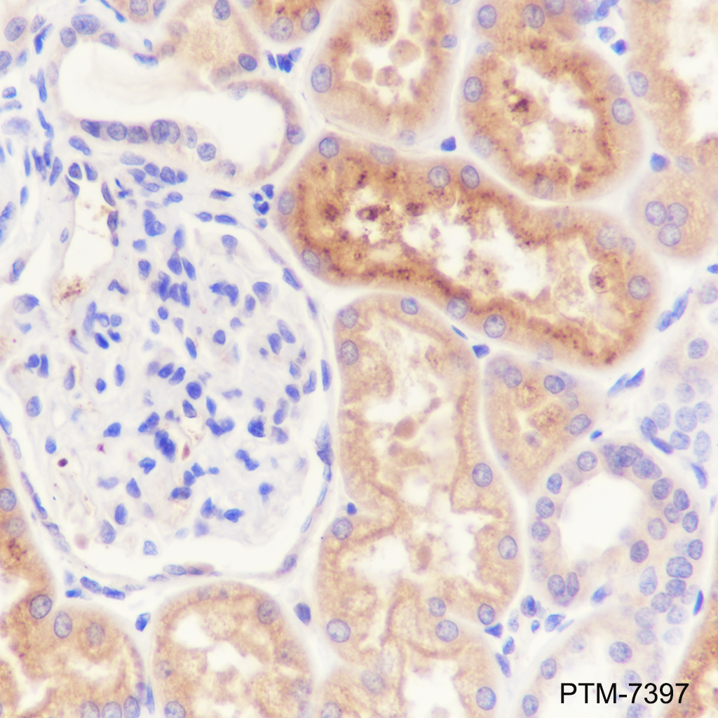 Anti-alpha 1 Antitrypsin Mouse mAb