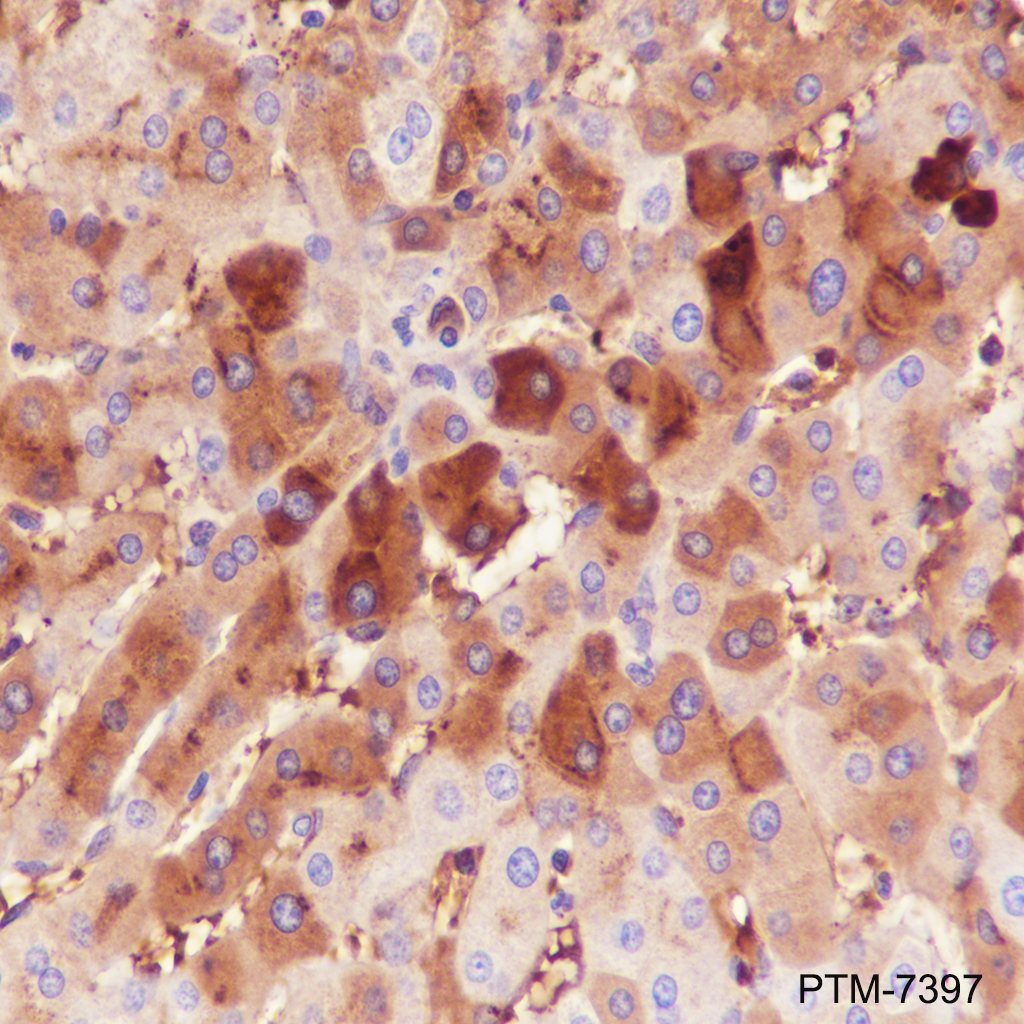Anti-alpha 1 Antitrypsin Mouse mAb