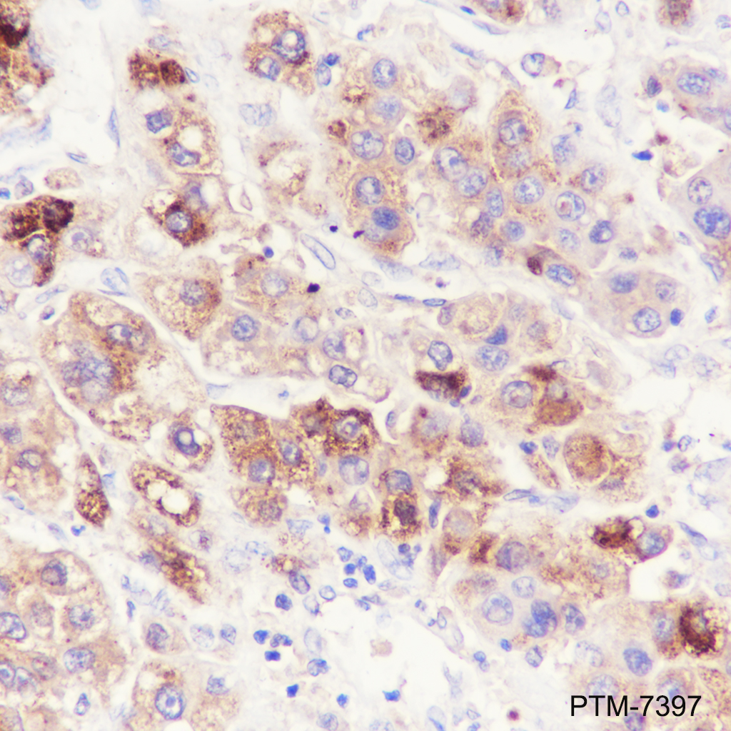 Anti-alpha 1 Antitrypsin Mouse mAb
