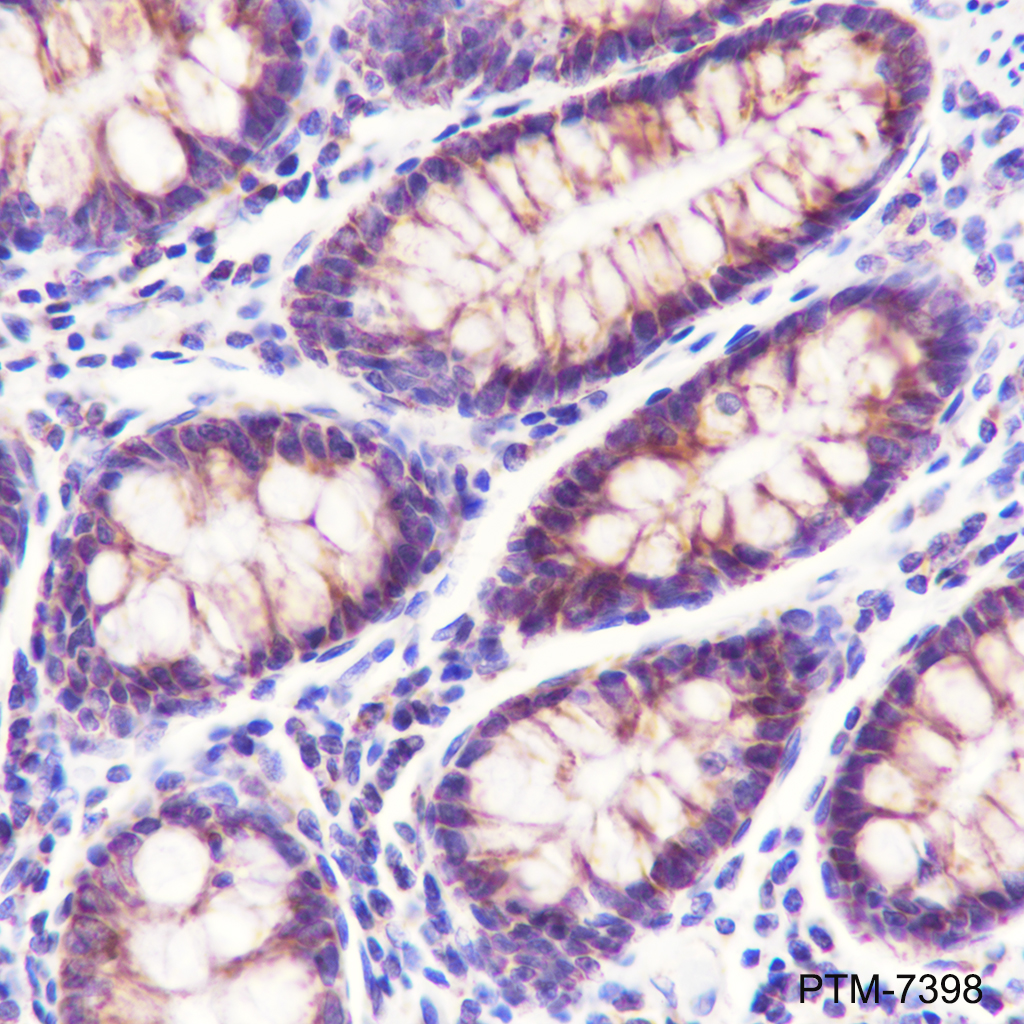 Anti-CHCHD2 Mouse mAb