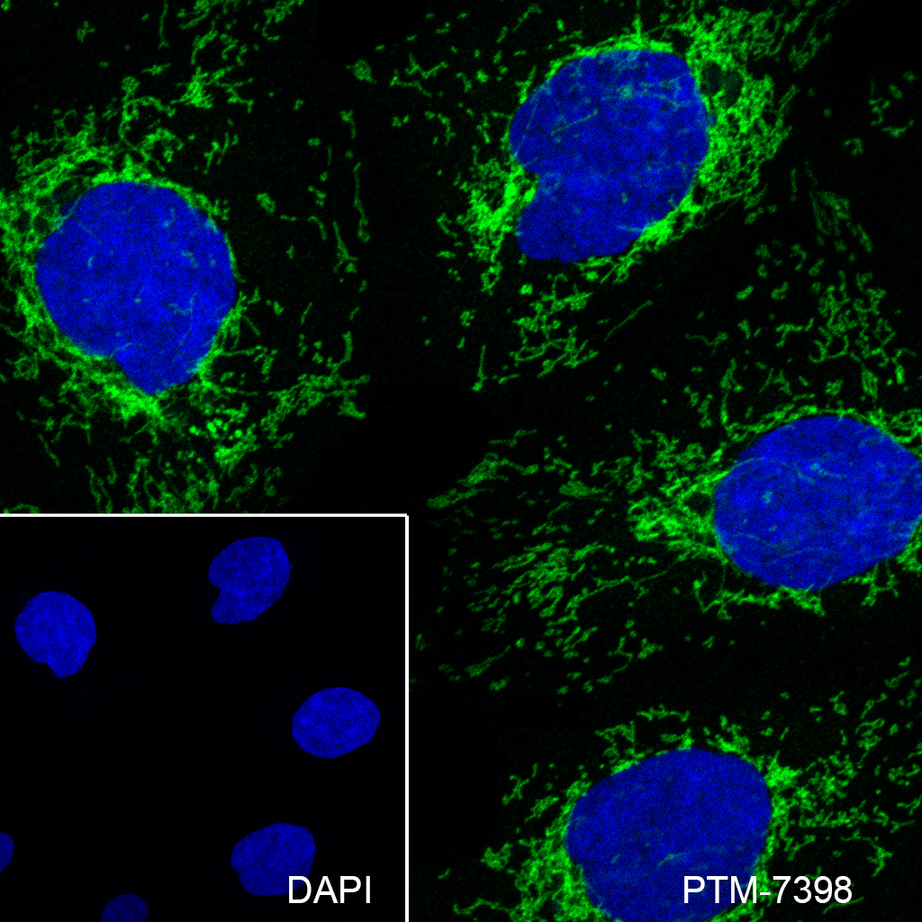 Anti-CHCHD2 Mouse mAb