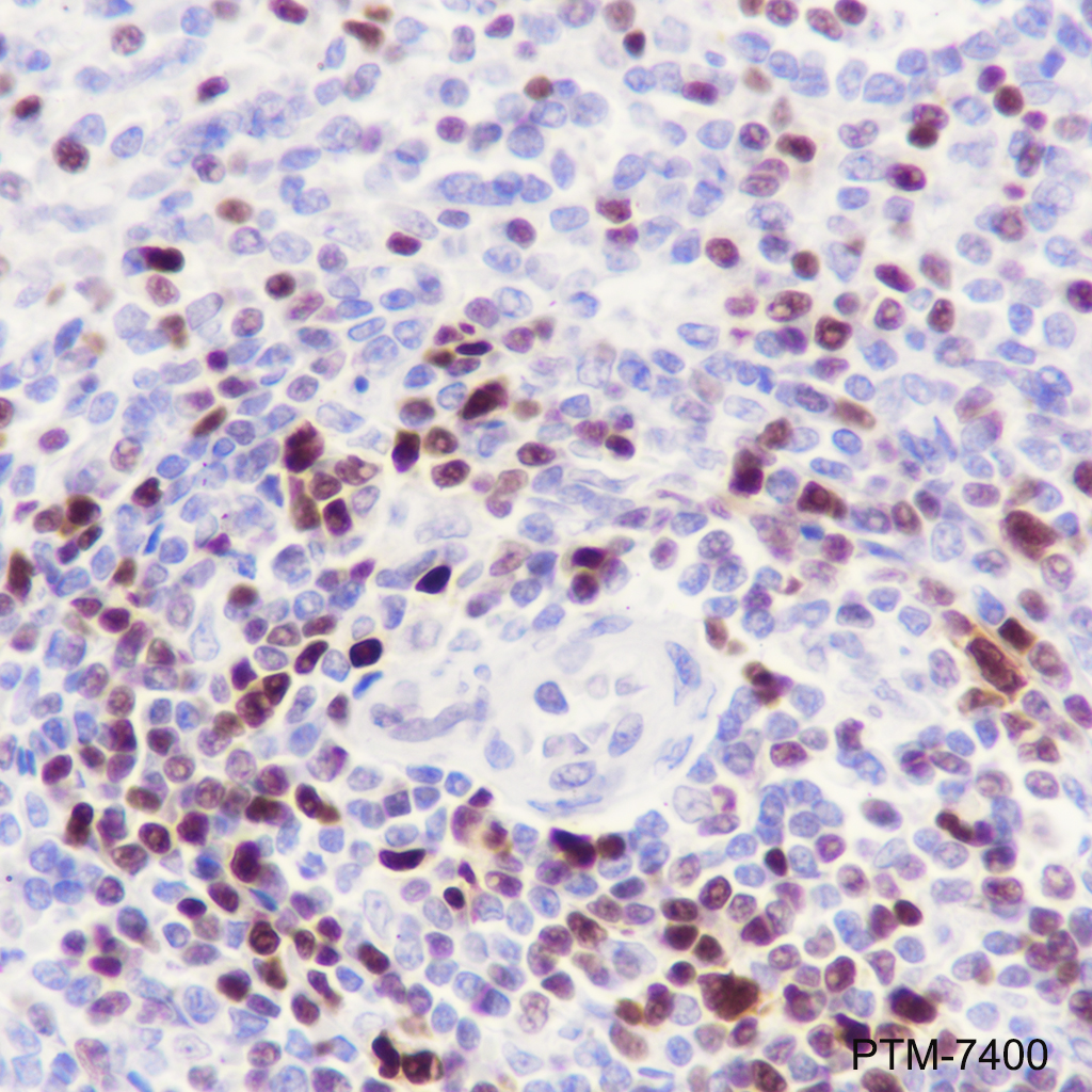 Anti-Tox Rabbit mAb