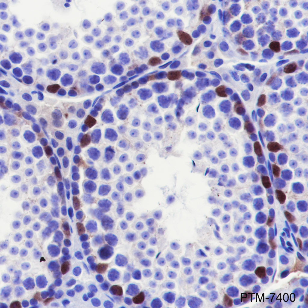 Anti-Tox Rabbit mAb