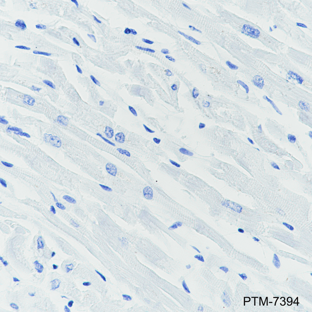 Anti-EBI3 Rabbit mAb