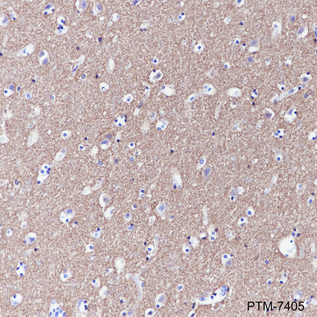 Anti-Rab3A Rabbit mAb