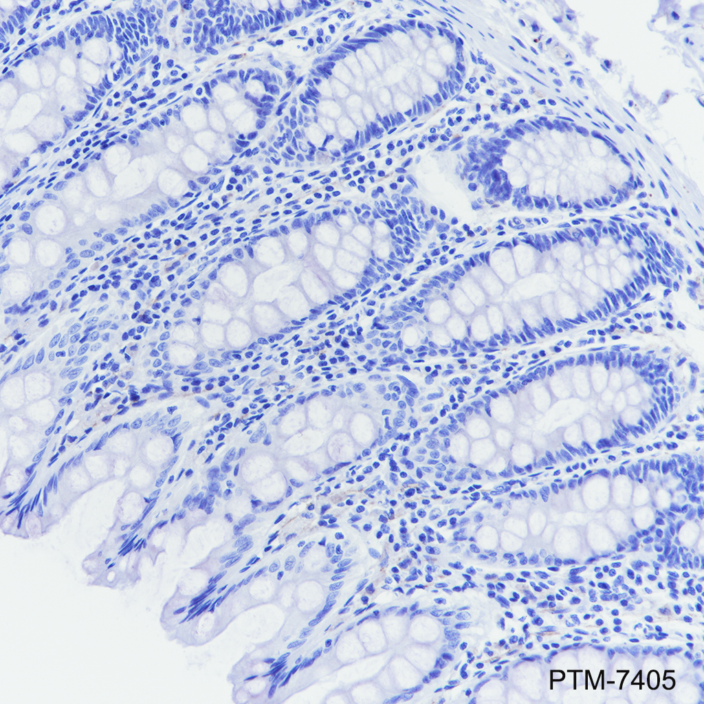 Anti-Rab3A Rabbit mAb