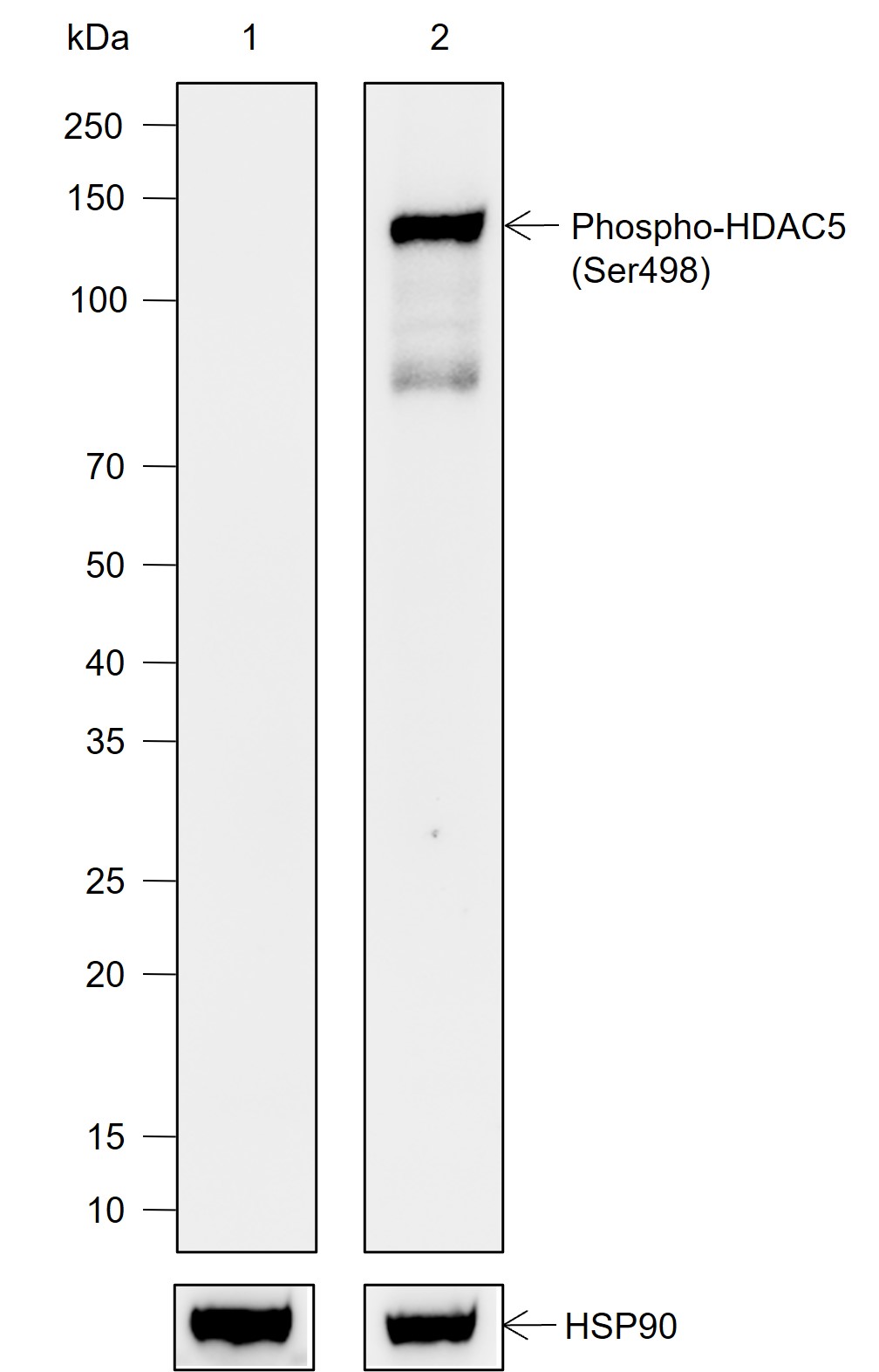 Anti-Phospho-HDAC5 (Ser498) Rabbit mAb