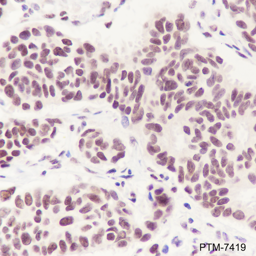 Anti-Phospho-STAT1 (Ser727) Rabbit mAb