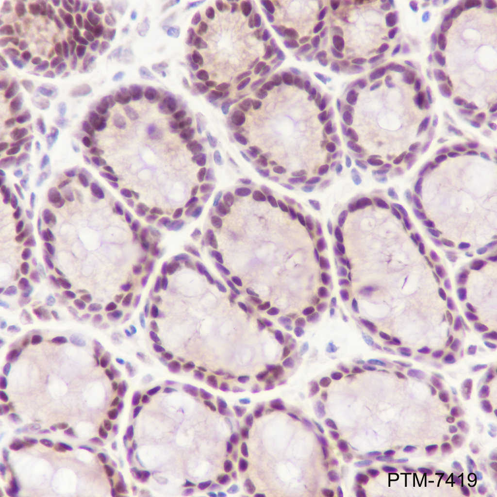 Anti-Phospho-STAT1 (Ser727) Rabbit mAb