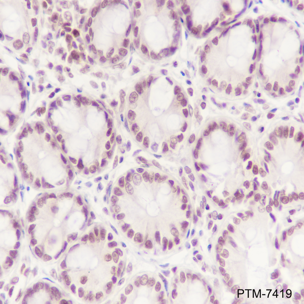 Anti-Phospho-STAT1 (Ser727) Rabbit mAb
