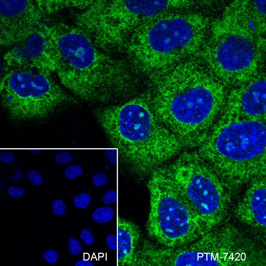 Anti-LIN28A Rabbit mAb