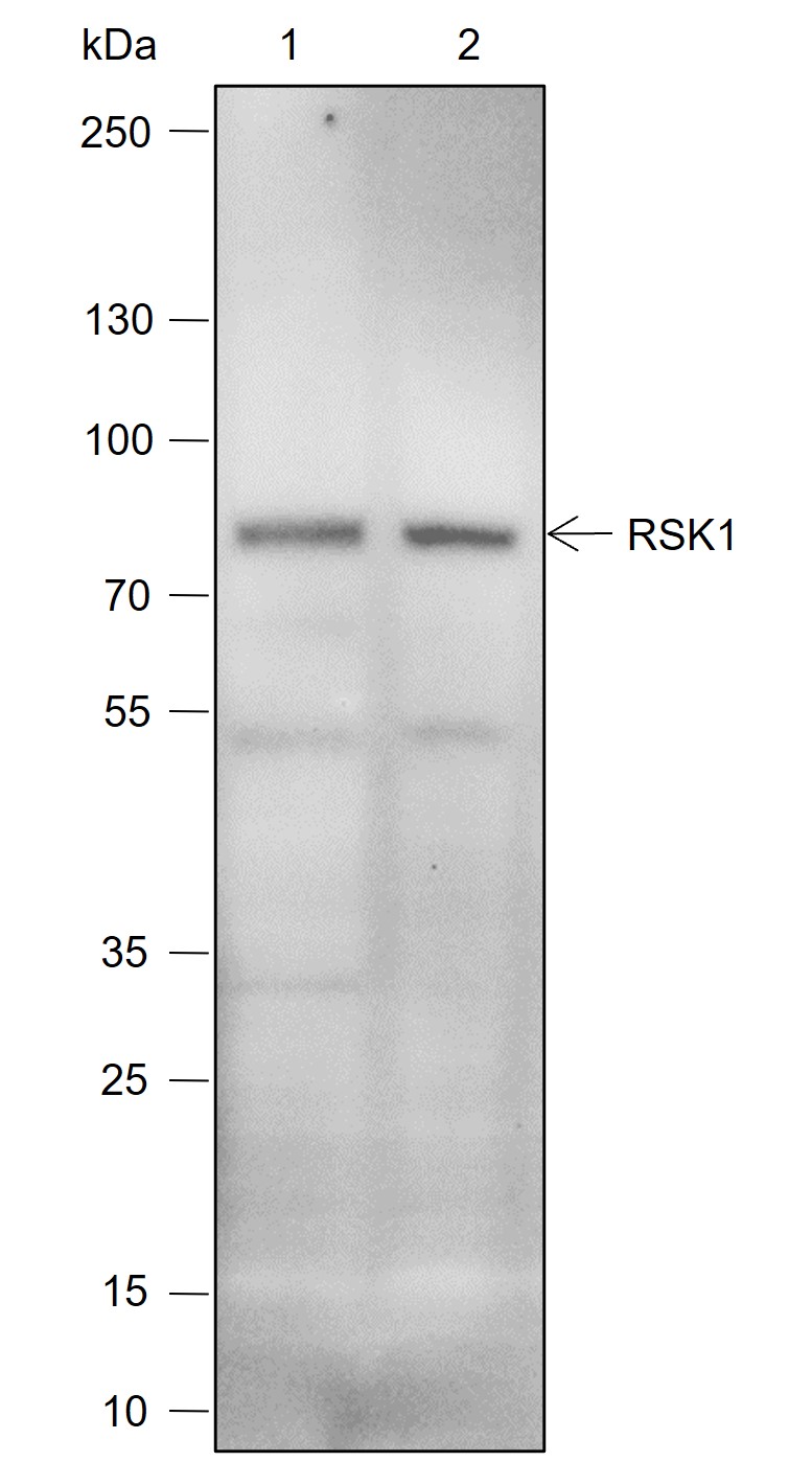 Anti-RSK1 Rabbit mAb