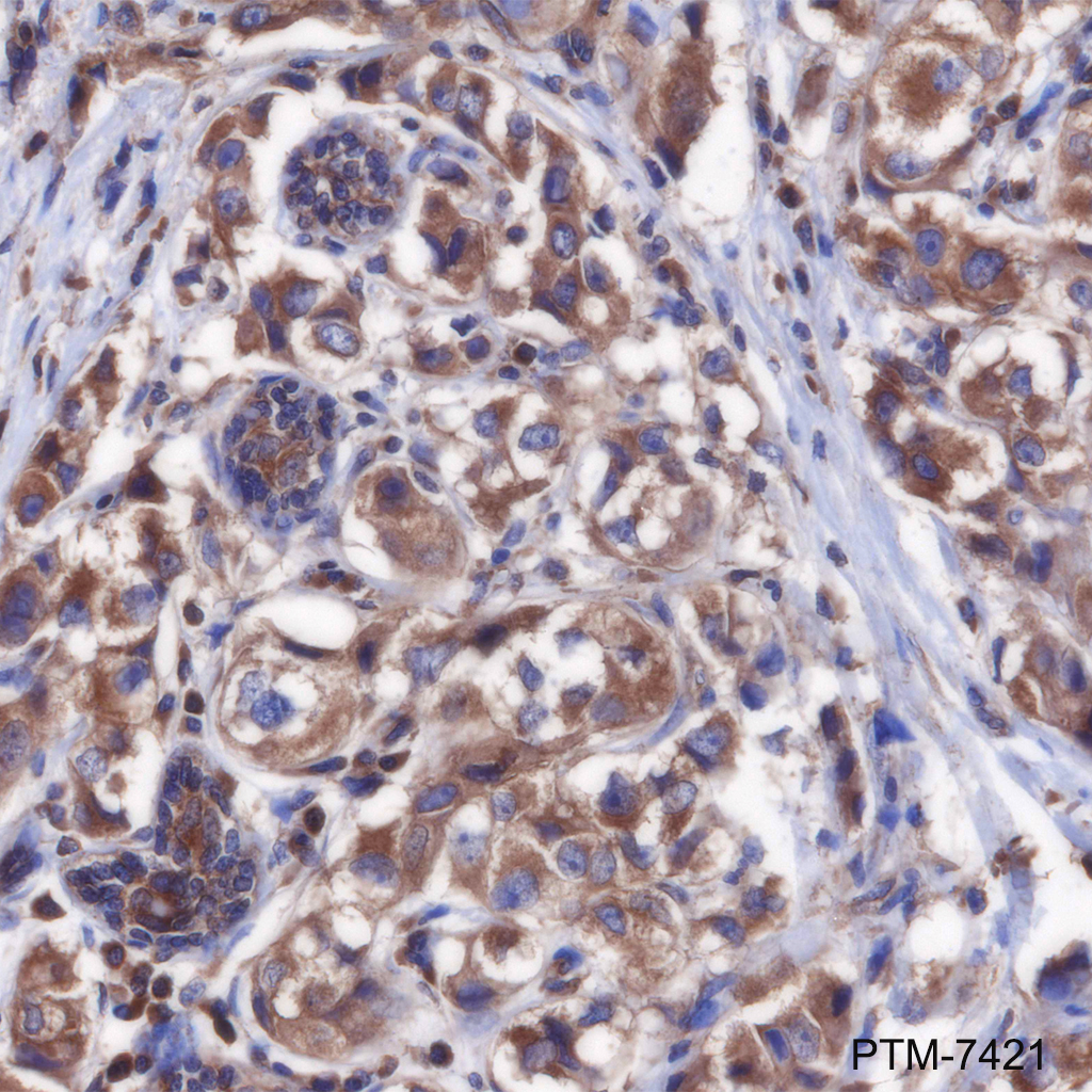 Anti-RSK1 Rabbit mAb