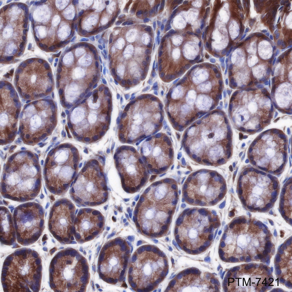 Anti-RSK1 Rabbit mAb