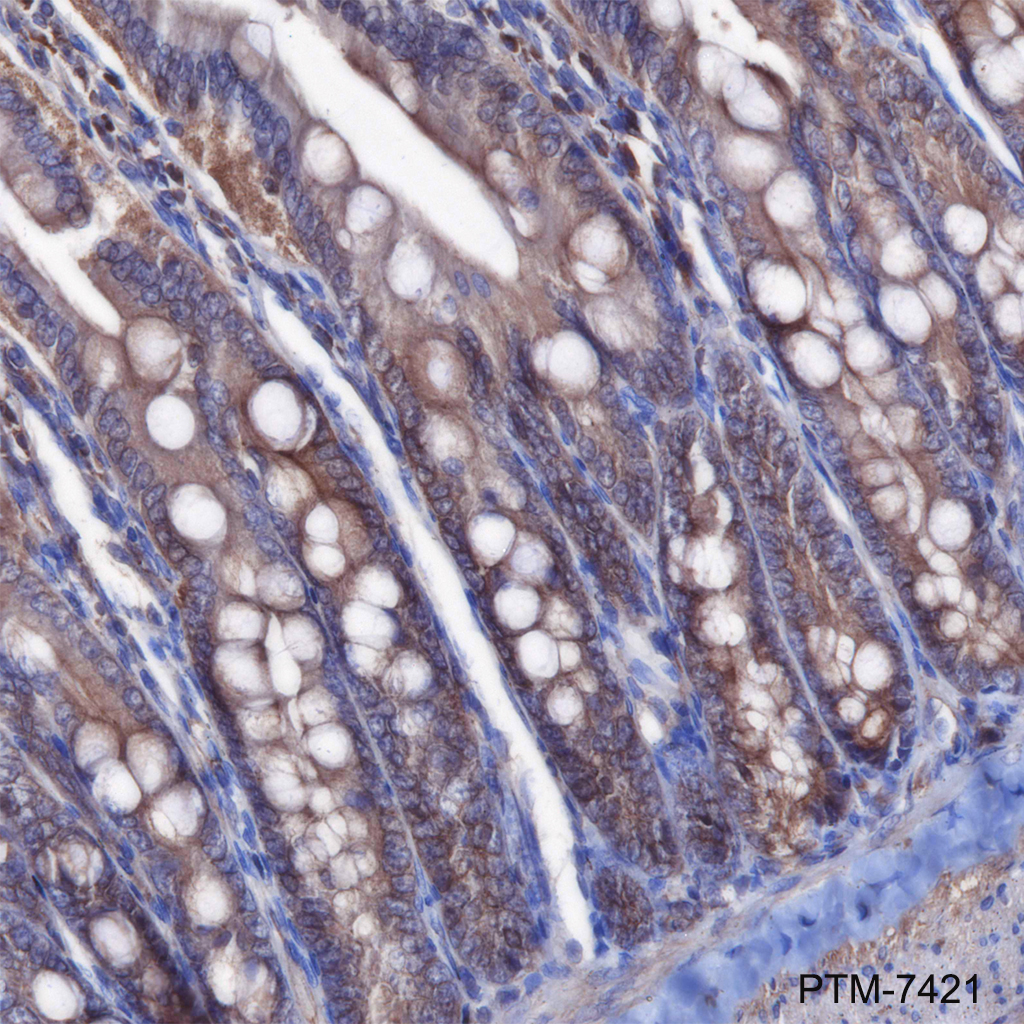 Anti-RSK1 Rabbit mAb