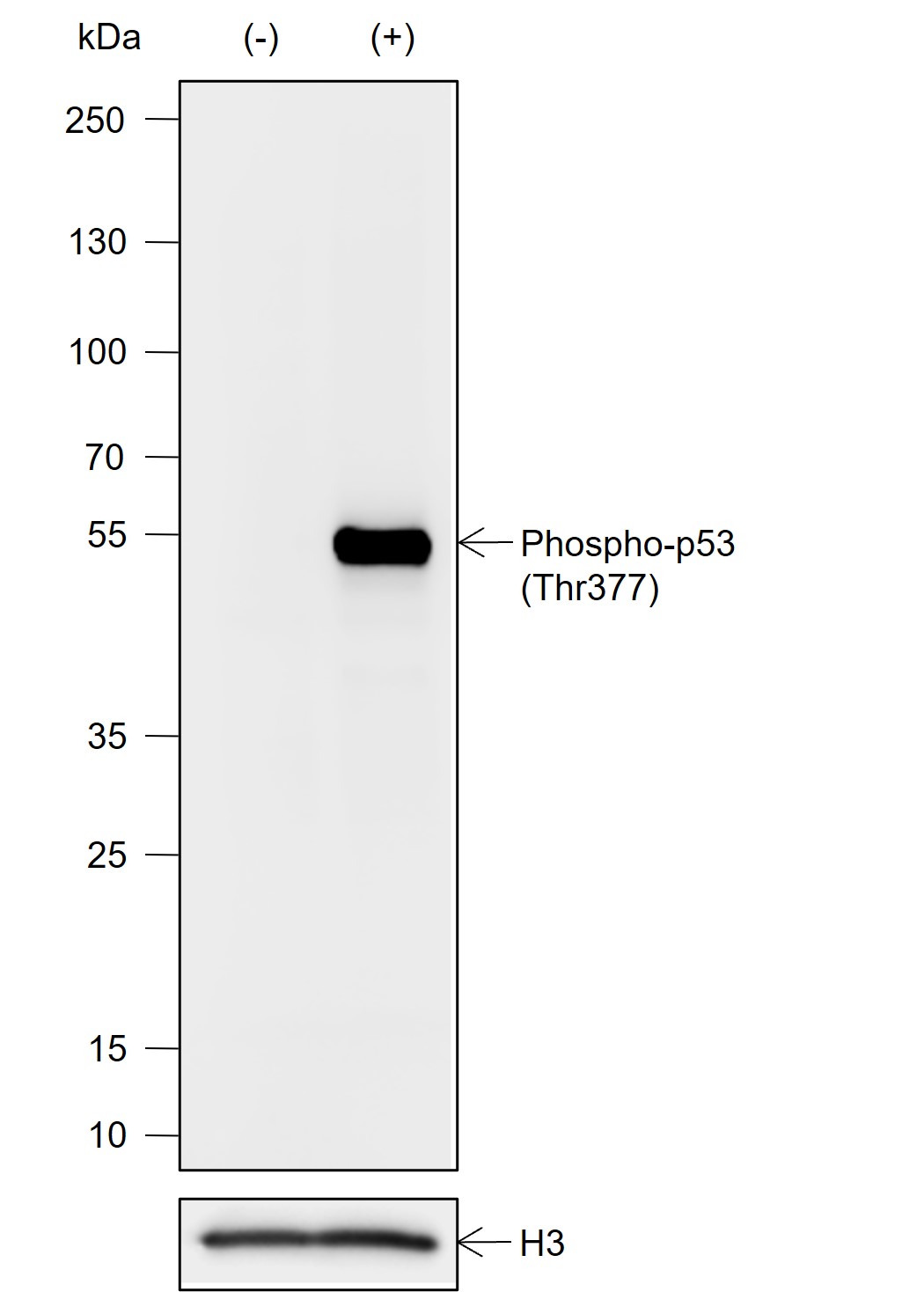 Anti-Phospho-p53 (Thr377) Rabbit mAb