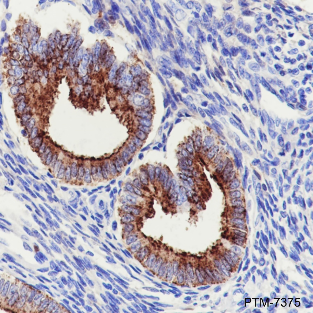 Anti-MMP7 Rabbit mAb