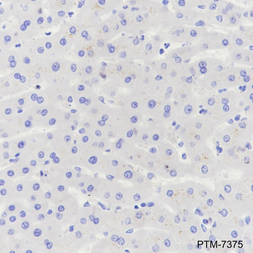 Anti-MMP7 Rabbit mAb