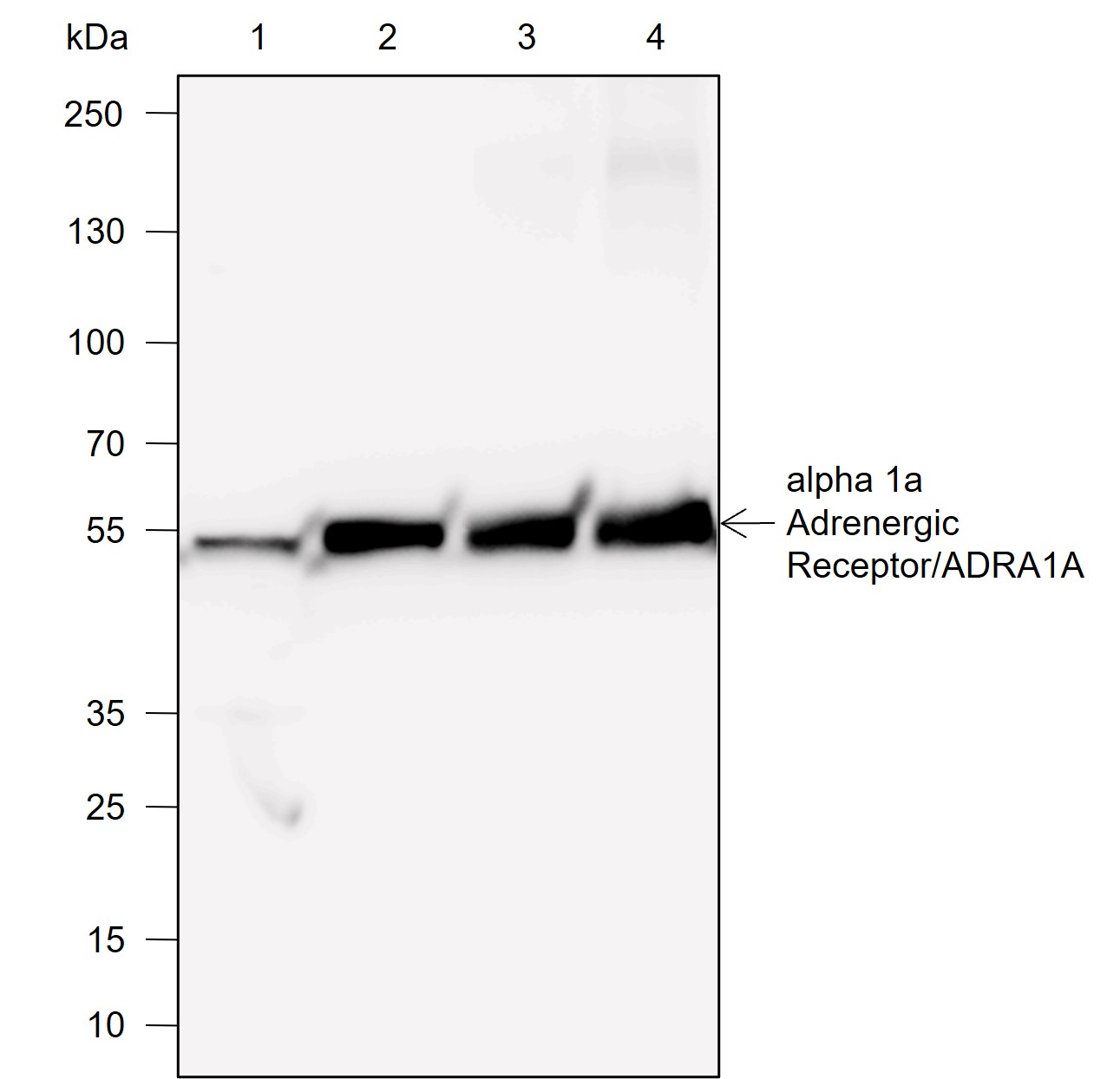 Anti-ADRA1A Rabbit mAb