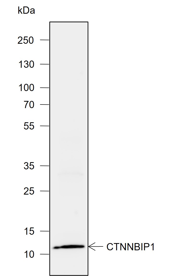 Anti-CTNNBIP1 Rabbit mAb