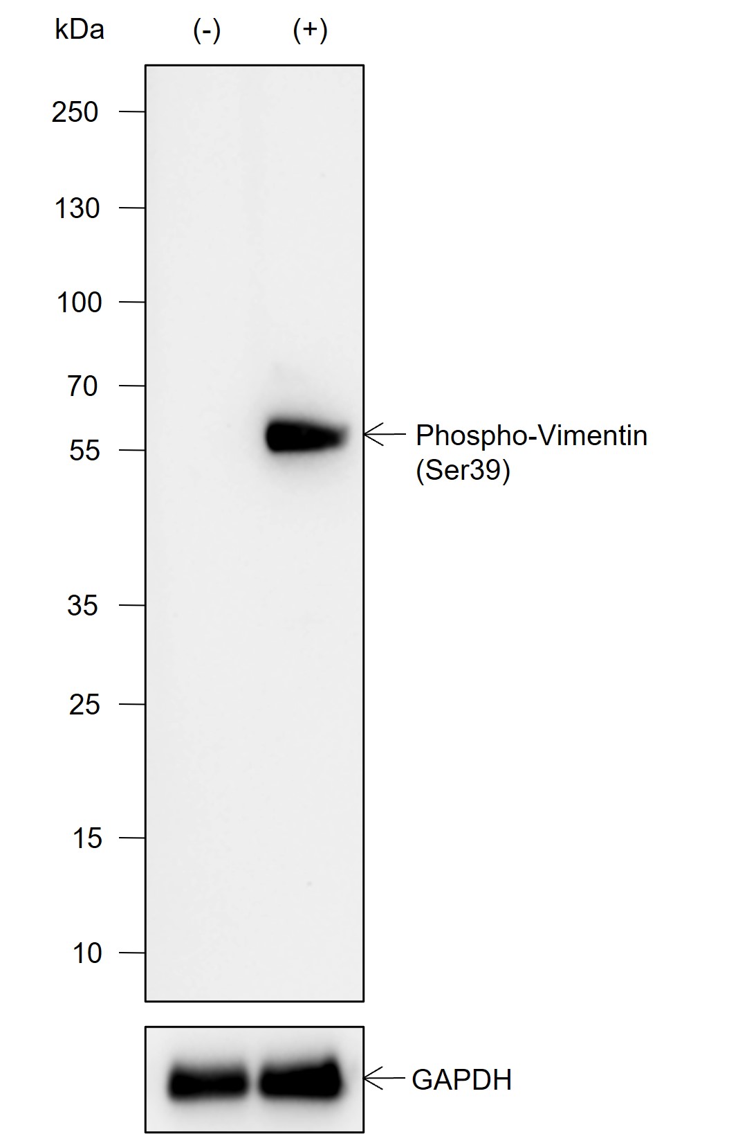 Anti-Phospho-Vimentin (Ser39) Rabbit mAb