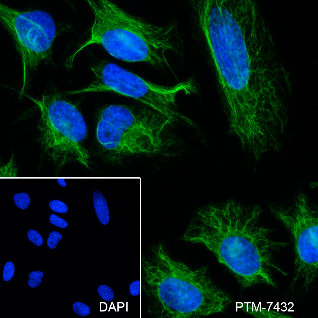 Anti-Phospho-Vimentin (Ser39) Rabbit mAb