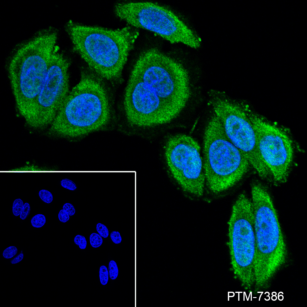 Anti-TRMT112 Mouse mAb