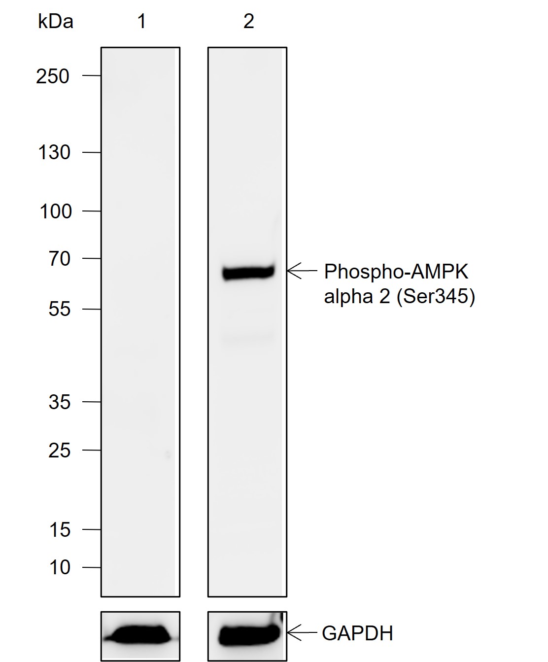 Anti-Phospho-AMPK alpha 2 (Ser345) Rabbit mAb