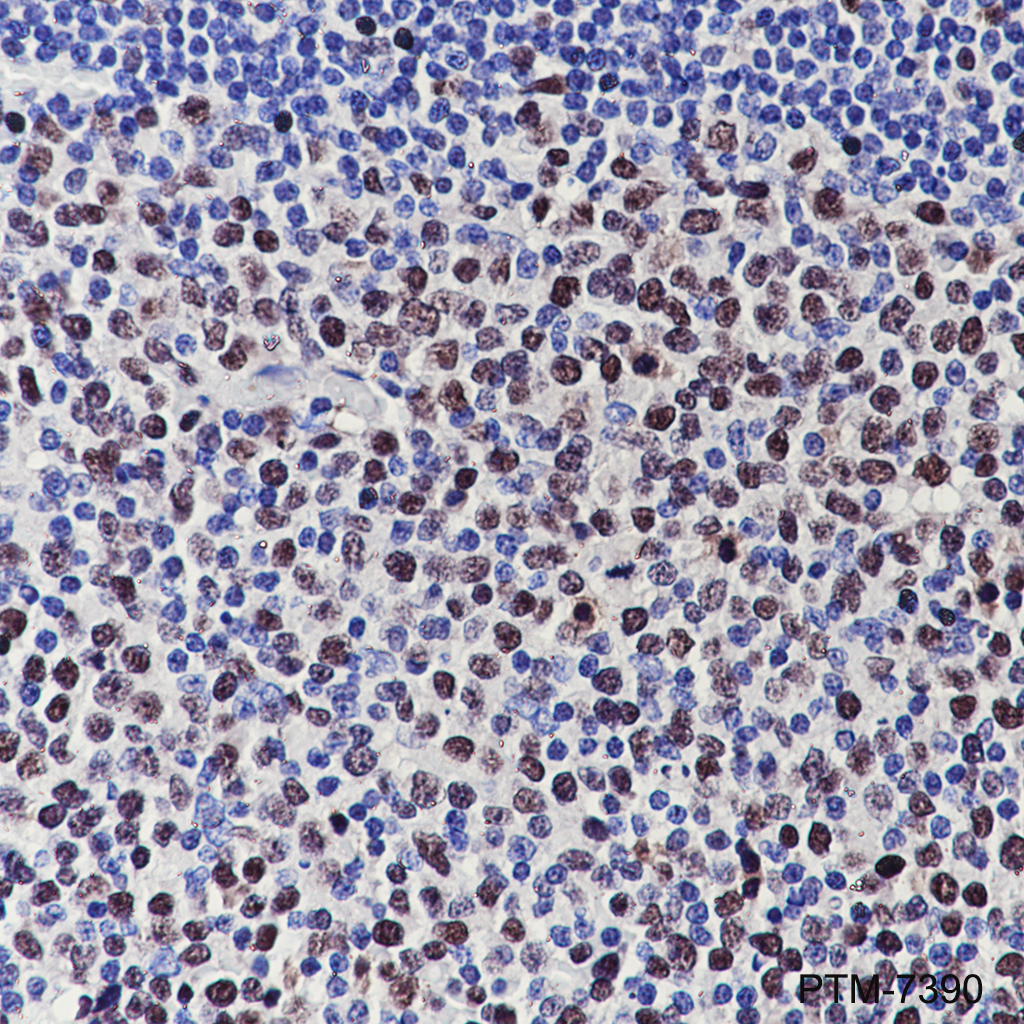 Anti-UHRF1 Mouse mAb
