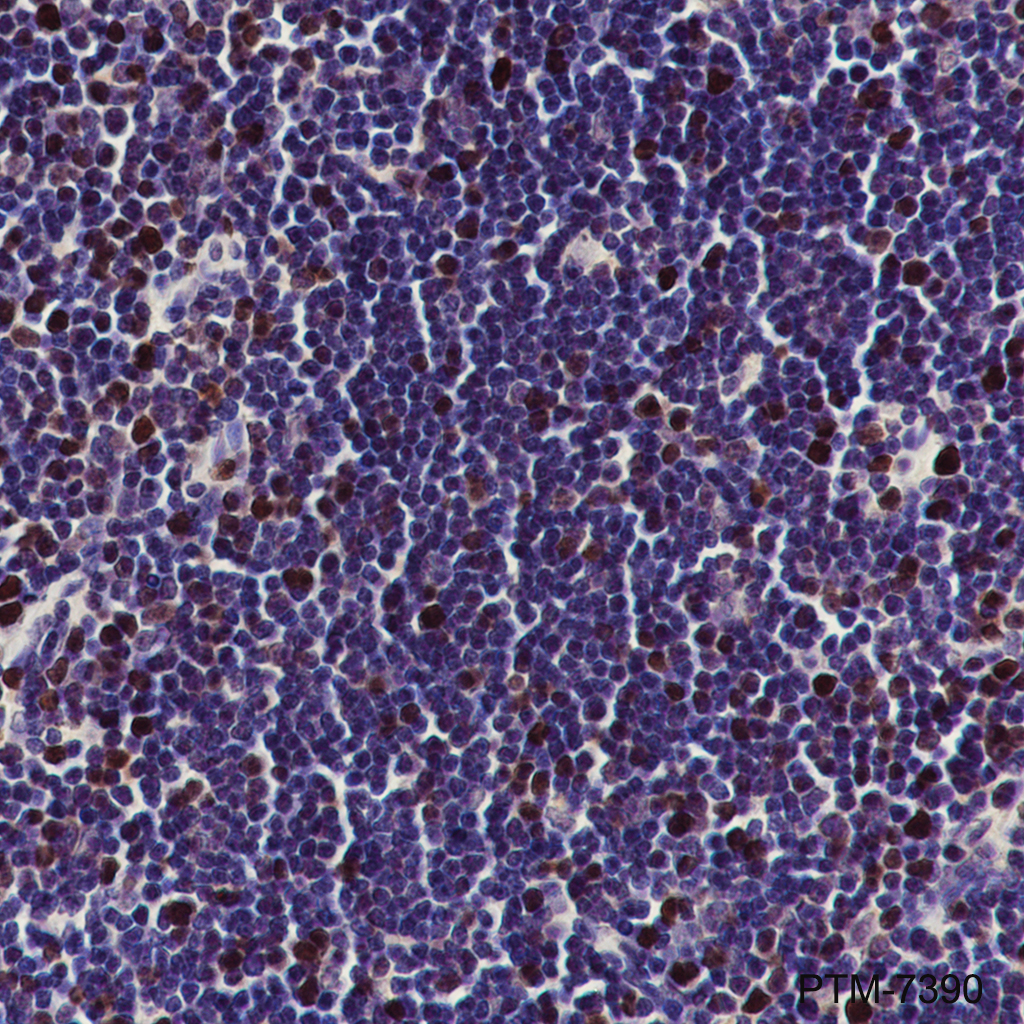 Anti-UHRF1 Mouse mAb