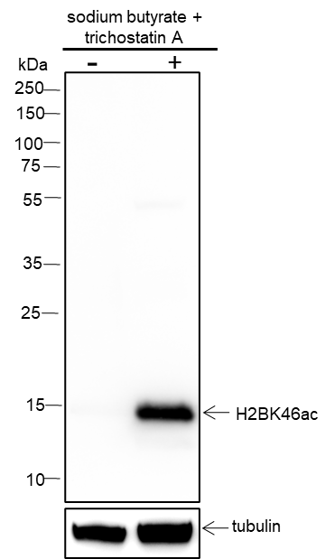 Anti-Acetyl-Histone H2B (Lys46) Rabbit mAb