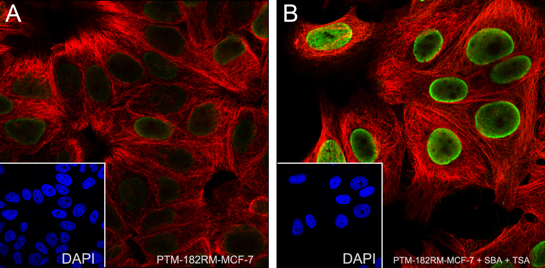 Anti-Acetyl-Histone H2B (Lys46) Rabbit mAb