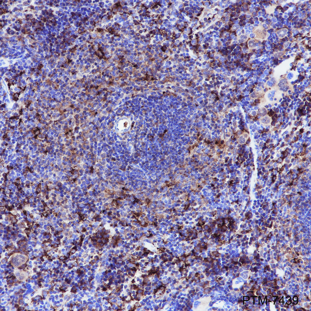 Anti-Ferritin Heavy Chain Rabbit mAb